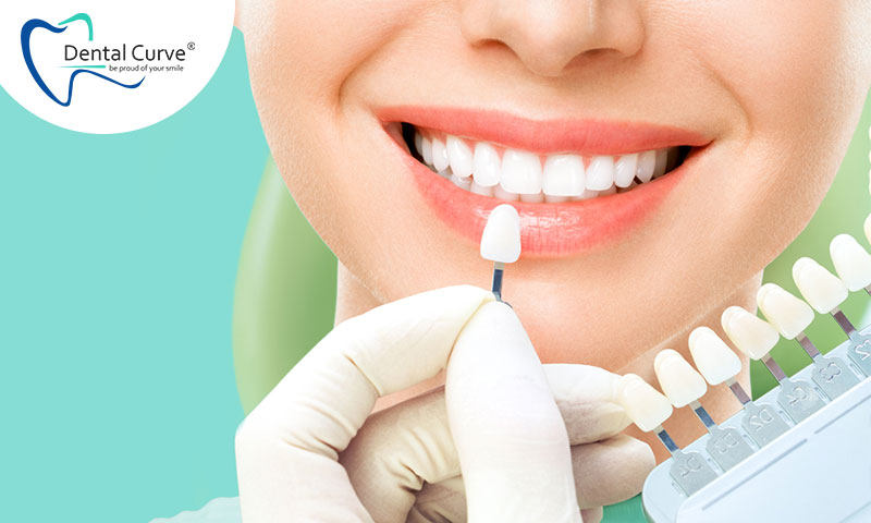 Teeth Whitening in Vasai