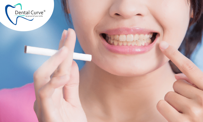 How often do you need to do a dental checkup?